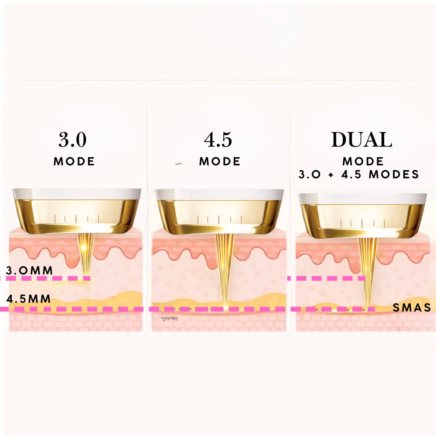 Cabezal Facial de Dualsonic professional